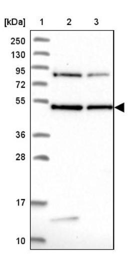 Western Blot: DENND1B Antibody [NBP2-47486] - Lane 1: Marker [kDa] 250, 130, 95, 72, 55, 36, 28, 17, 10.  Lane 2: Human cell line RT-4.  Lane 3: Human cell line U-251MG.