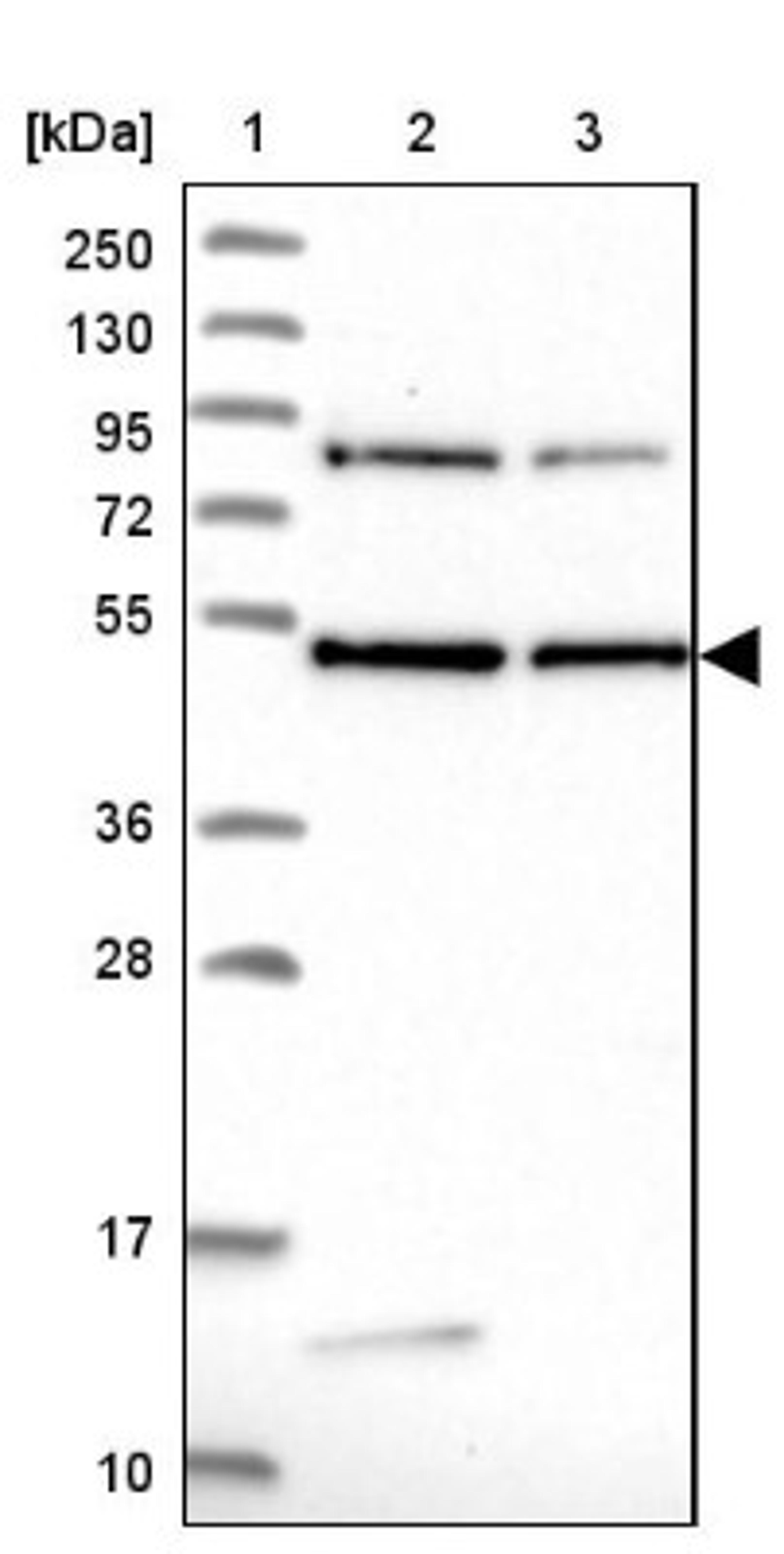 Western Blot: DENND1B Antibody [NBP2-47486] - Lane 1: Marker [kDa] 250, 130, 95, 72, 55, 36, 28, 17, 10.  Lane 2: Human cell line RT-4.  Lane 3: Human cell line U-251MG.