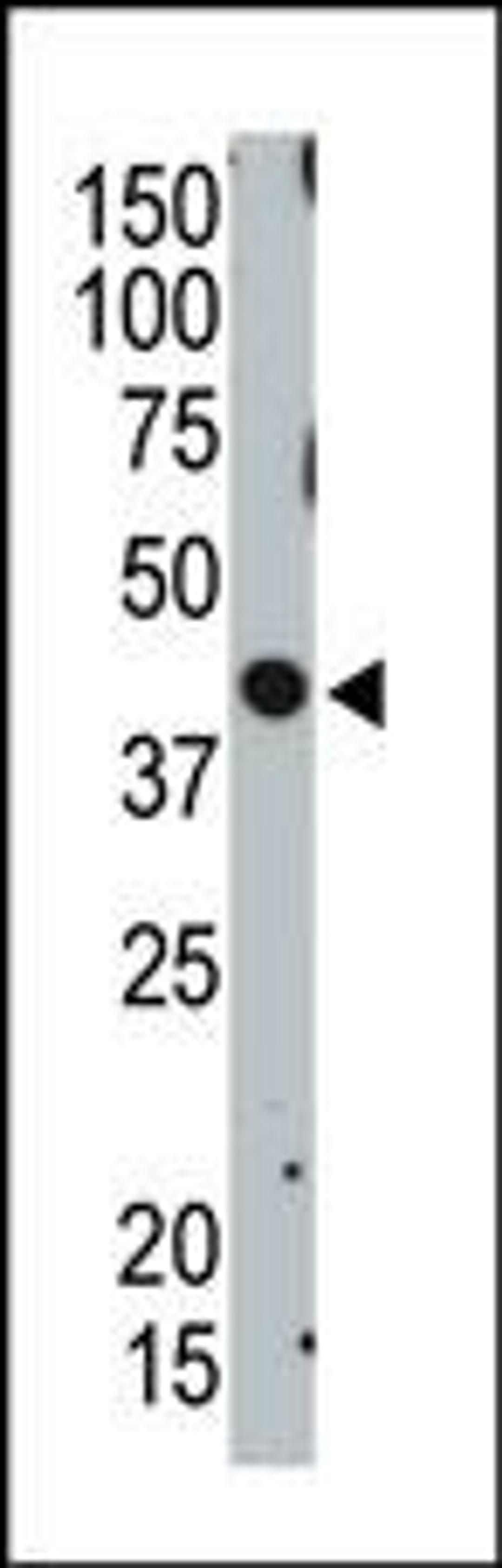 Antibody is used in Western blot to detect TSG101 in ZR75-1 cell lysate