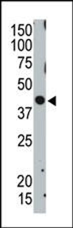 Antibody is used in Western blot to detect TSG101 in ZR75-1 cell lysate