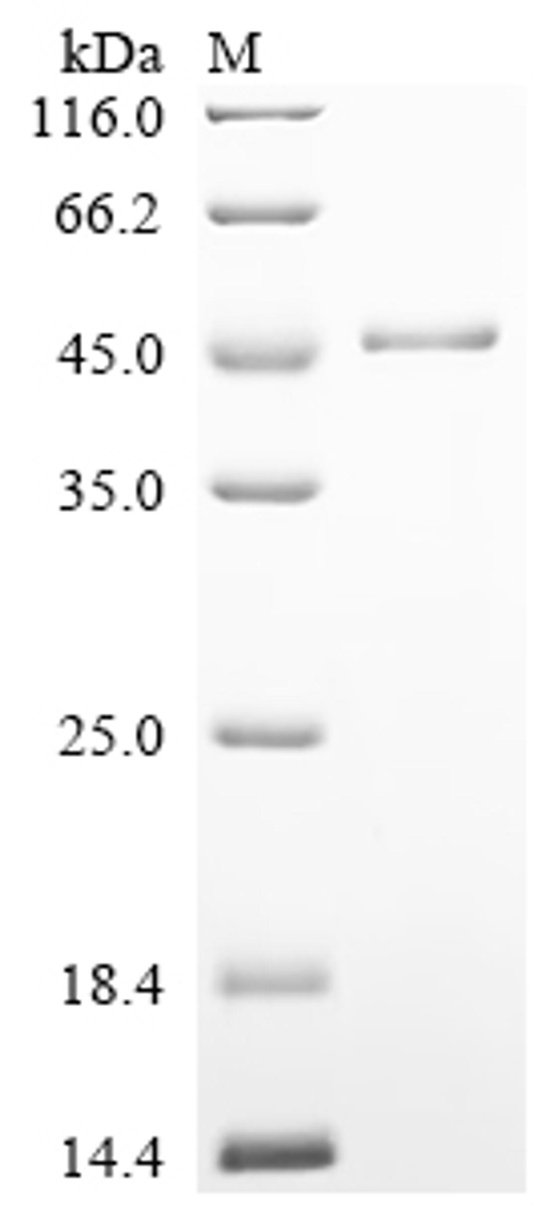(Tris-Glycine gel) Discontinuous SDS-PAGE (reduced) with 5% enrichment gel and 15% separation gel.