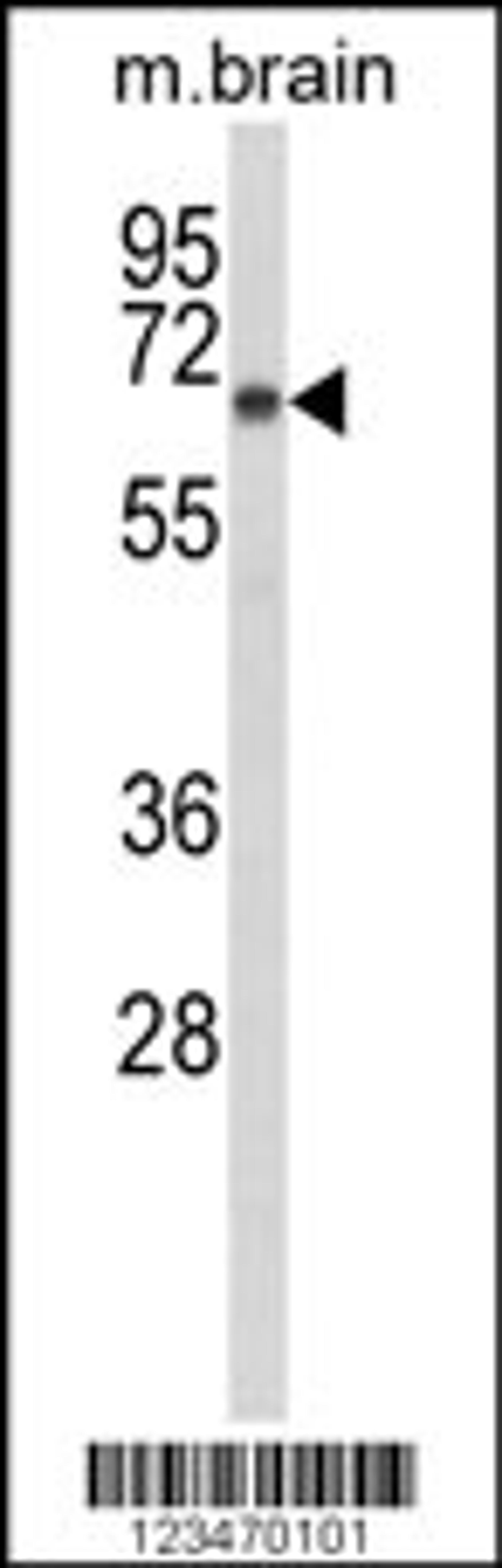 Western blot analysis of DAB1 Antibody in mouse brain tissue lysates (35ug/lane)