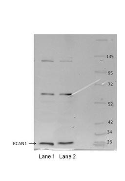 Antibody used in WB on mouse osteoclasts at 1:1000.