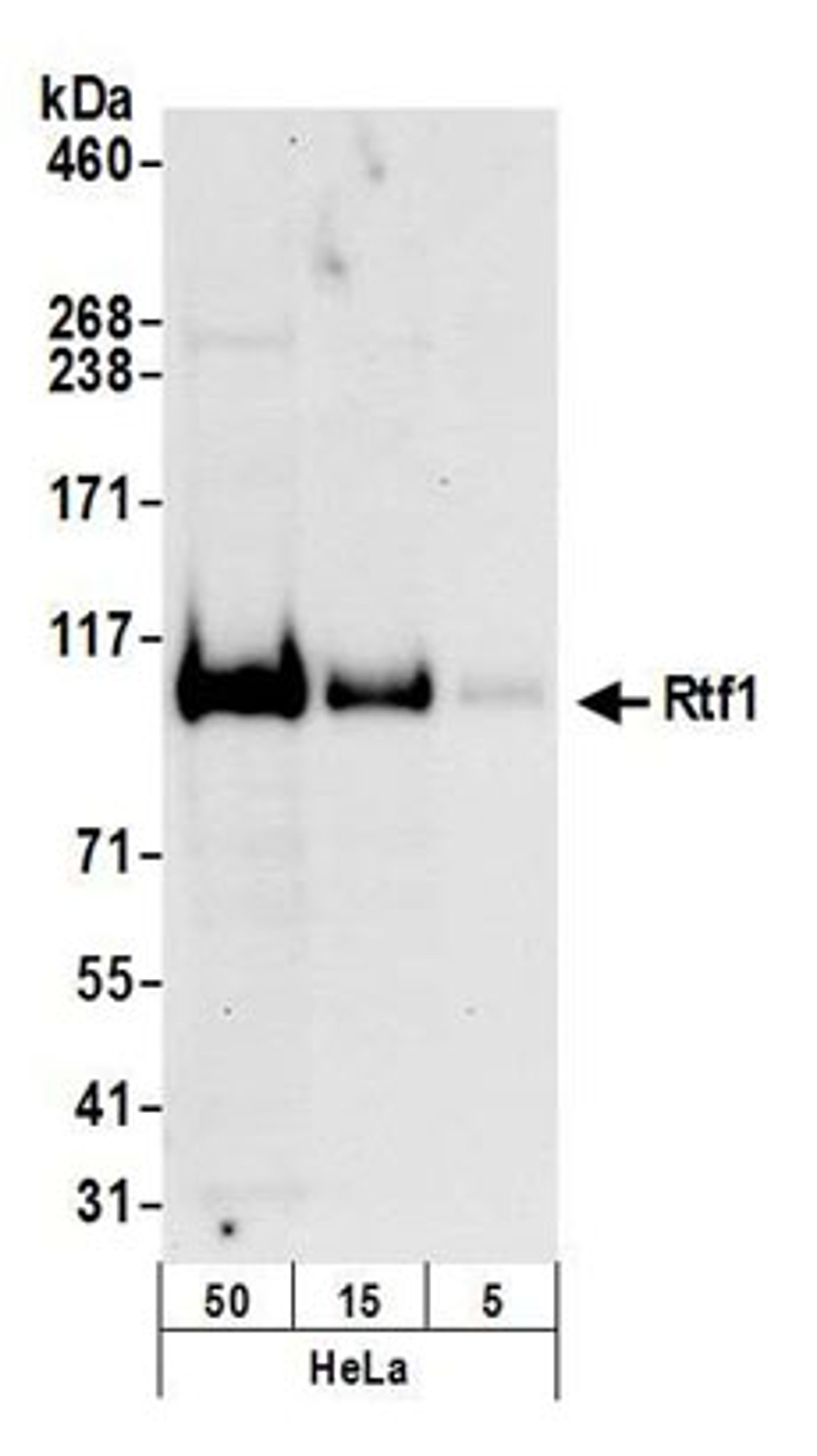 Detection of human Rtf1 by western blot.