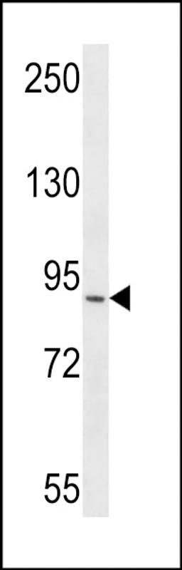 Western blot analysis in CEM cell line lysates (35ug/lane).