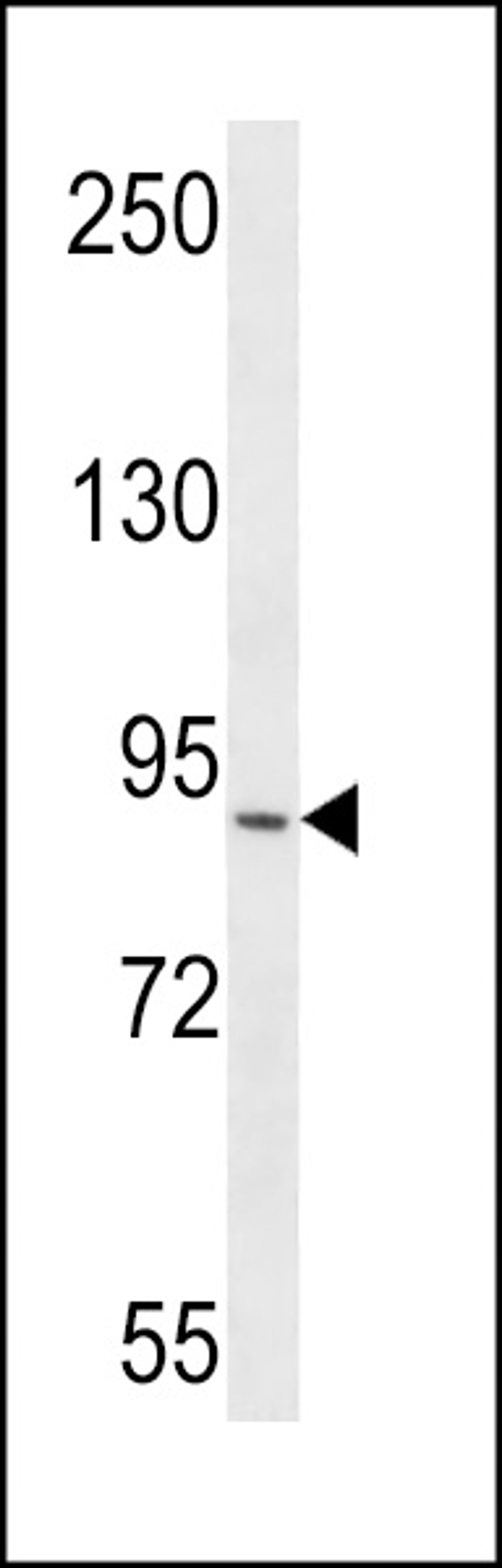 Western blot analysis in CEM cell line lysates (35ug/lane).