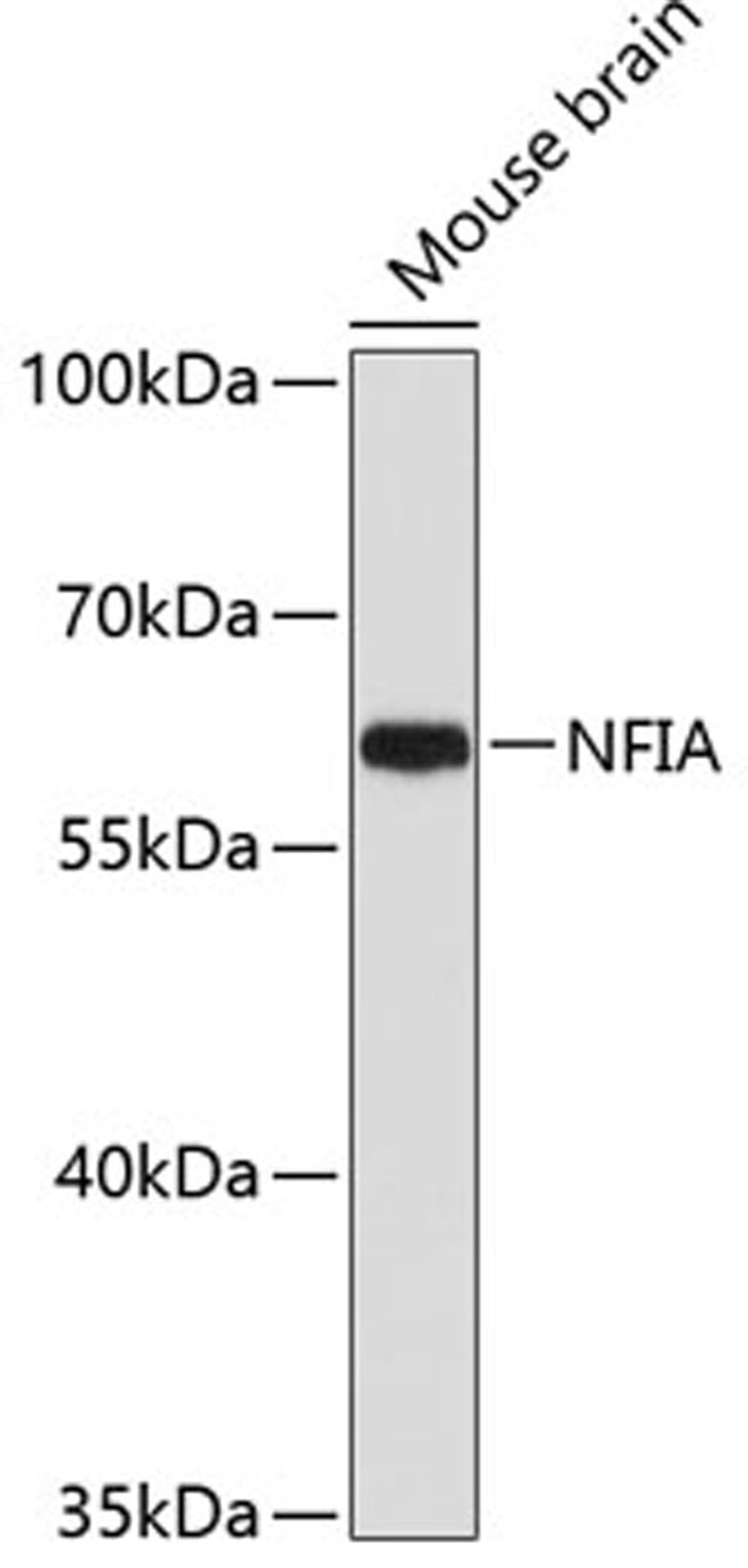 Western blot - NFIA antibody (A3258)