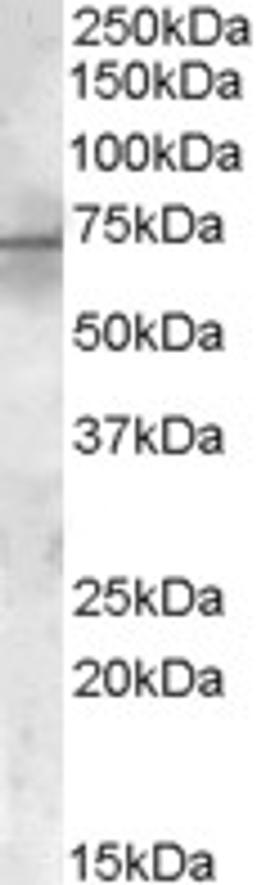 46-155 (1ug/ml) staining of Rat Heart lysate (35ug protein in RIPA buffer). Primary incubation was 1 hour. Detected by chemiluminescence.