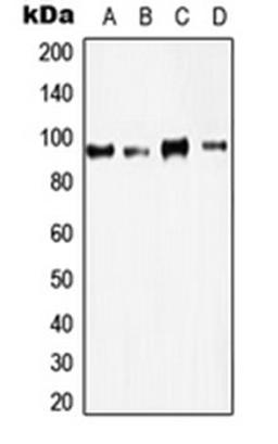 Western blot analysis of A431 (Lane 1), HeLa (Lane 2), HT29 (Lane 3), A549 (Lane 4) whole cell lysates using KAT2B antibody