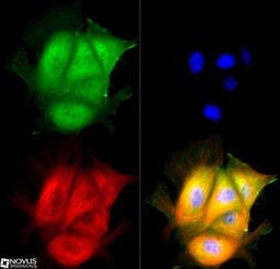 Immunocytochemistry/Immunofluorescence: Cyr61/CCN1 Antibody [NB100-357] - CYR61 antibody was tested in MCF-7 cells with DyLight 488 (green). Nuclei and alpha-tubulin were counterstained with DAPI (blue) and Dylight 550 (red).