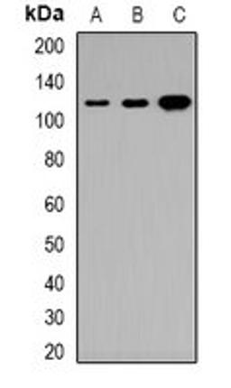 Western blot analysis of HeLa (Lane1), DLD (Lane2), H9C2 (Lane3) whole cell lysates using TNS3 antibody