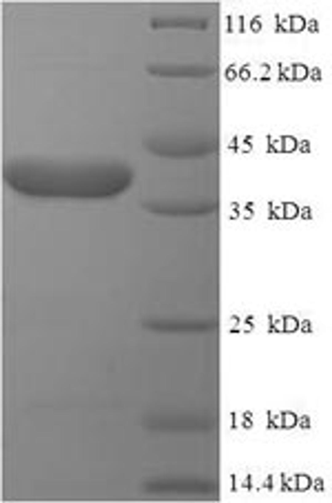 (Tris-Glycine gel) Discontinuous SDS-PAGE (reduced) with 5% enrichment gel and 15% separation gel.