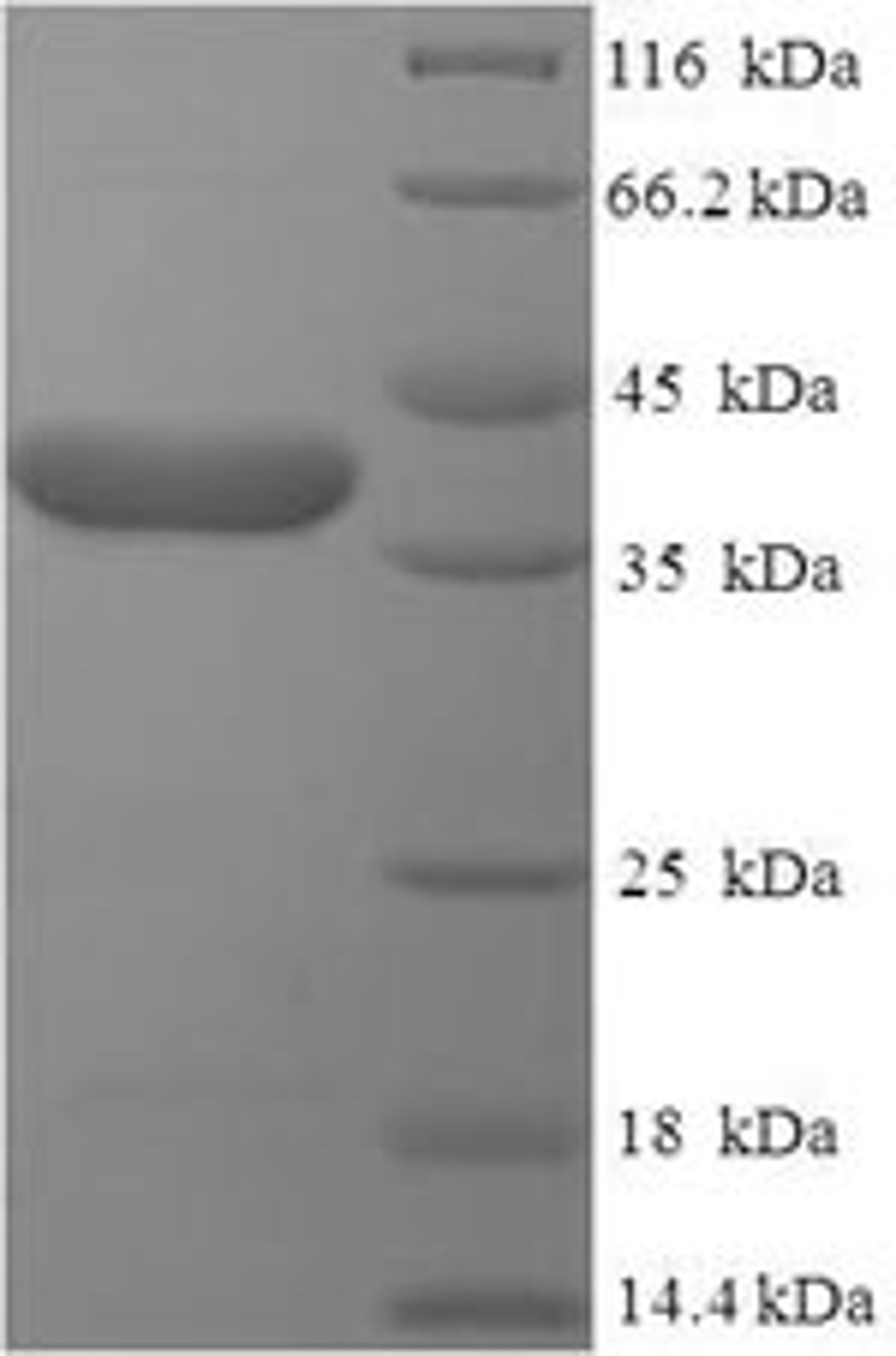 (Tris-Glycine gel) Discontinuous SDS-PAGE (reduced) with 5% enrichment gel and 15% separation gel.