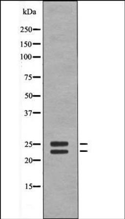 Western blot analysis of UV treated Jurkat whole cell lysates using BIM -Phospho-Ser59- antibody