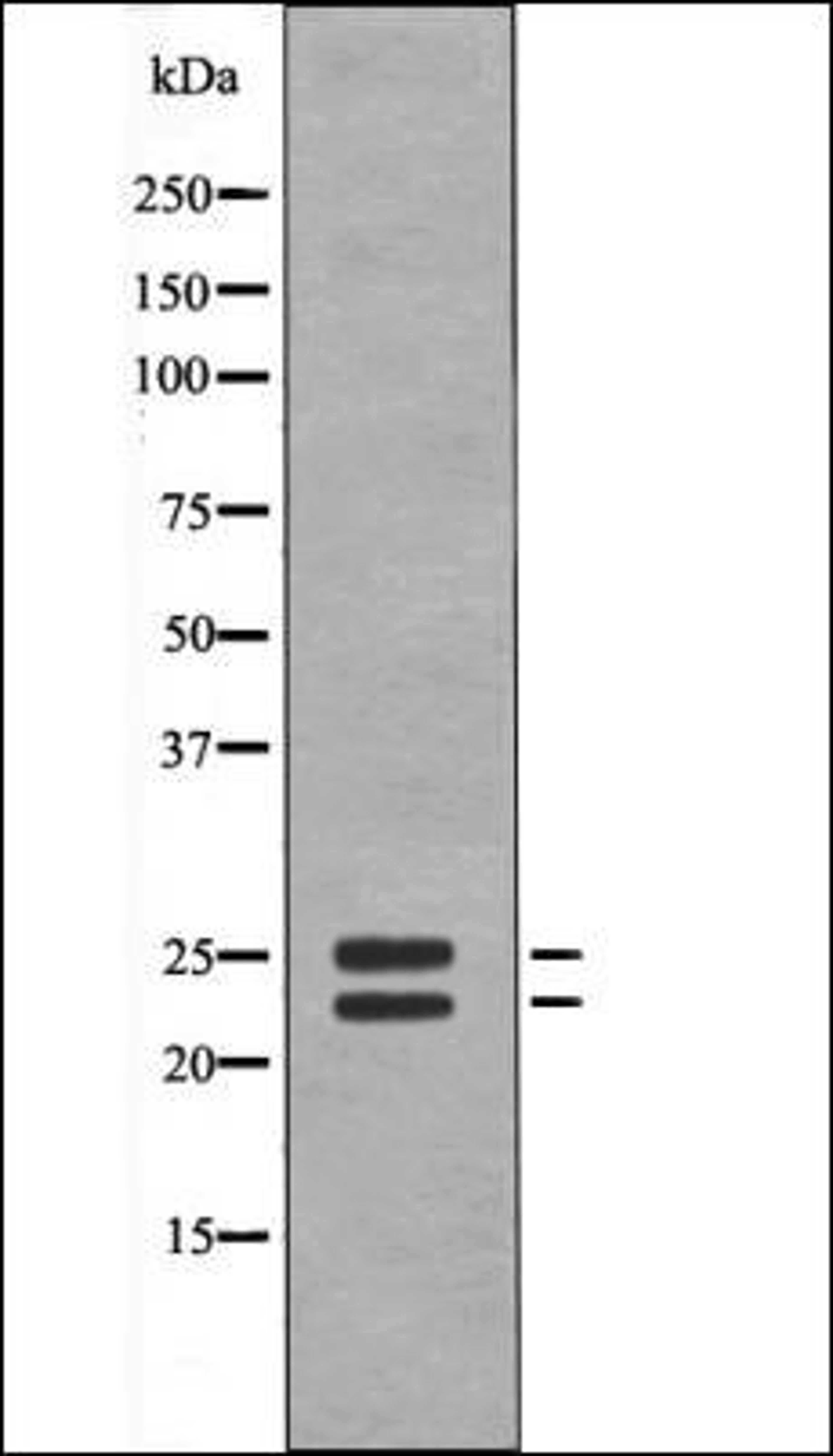 Western blot analysis of UV treated Jurkat whole cell lysates using BIM -Phospho-Ser59- antibody