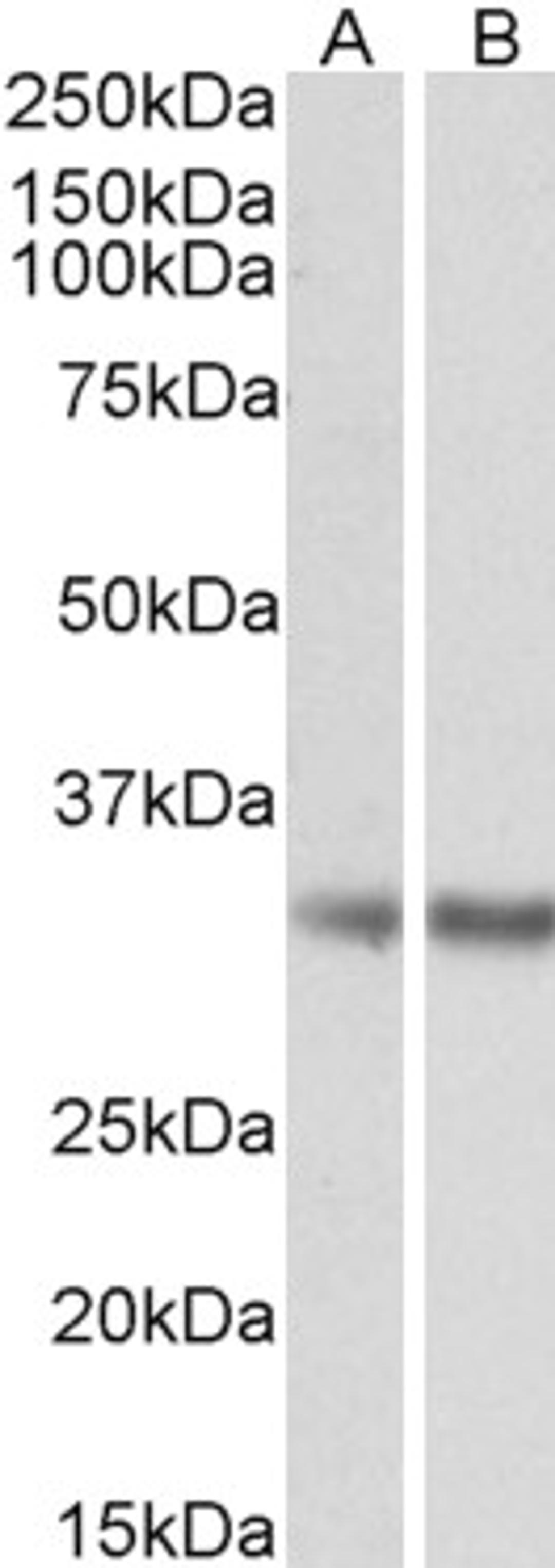 45-896 (0.5ug/ml) staining of Human Frontal Cortex (A) and Mouse Adipose (B) lysates (35ug protein in RIPA buffer). Detected by chemiluminescence.