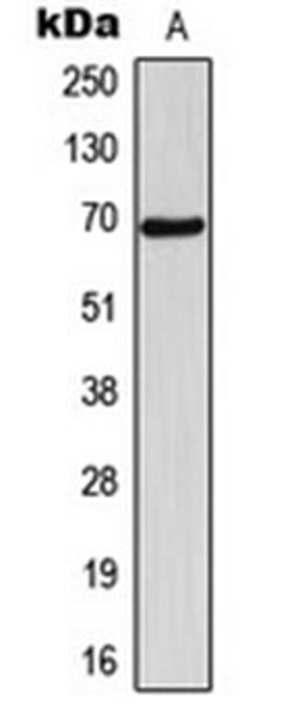 Western blot analysis of EAhy926 (Lane 1) whole cell lysates using NT5C1B antibody