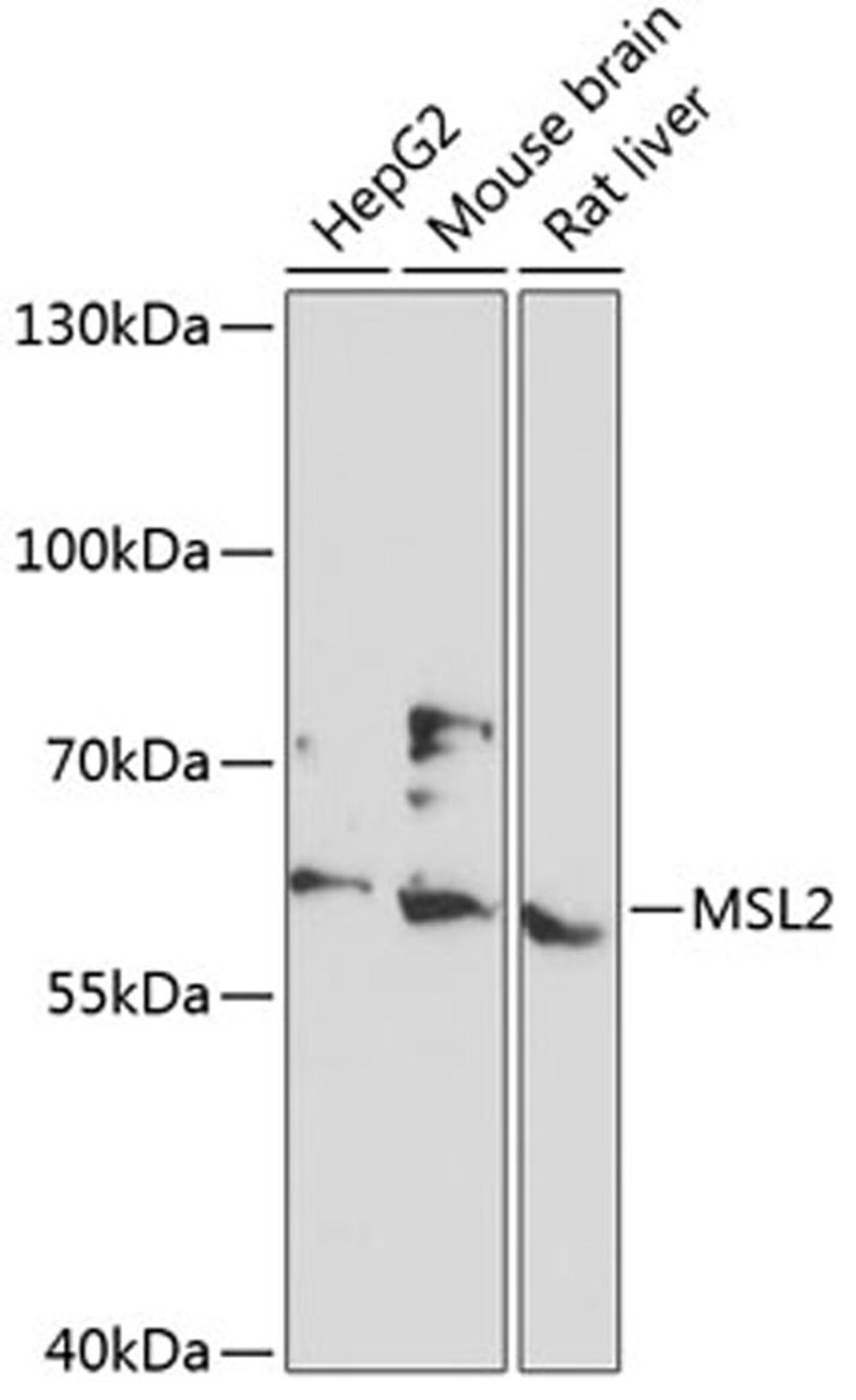 Western blot - MSL2 antibody (A13103)