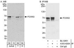 Detection of human FOXN3 by western blot and immunoprecipitation.