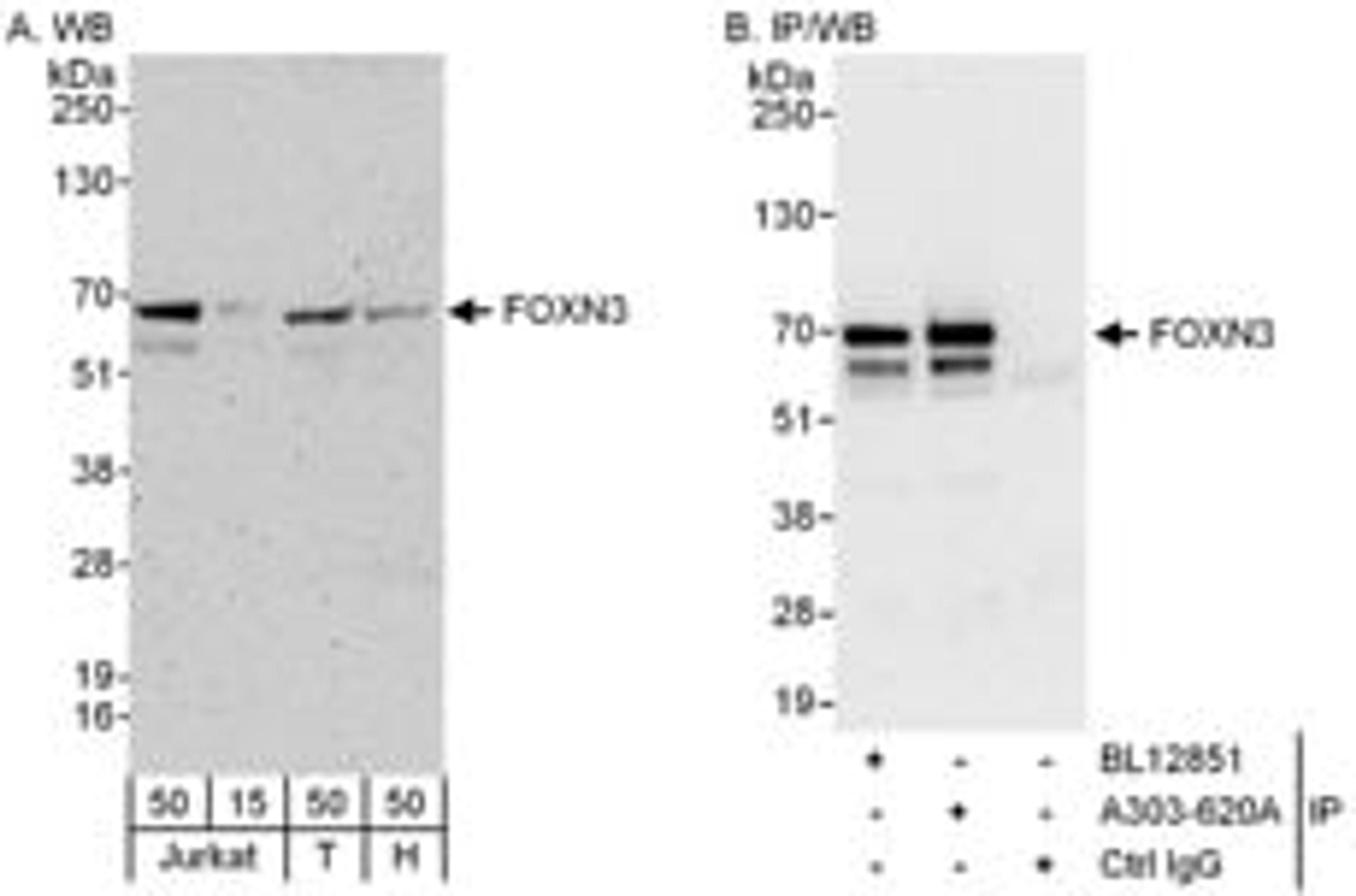 Detection of human FOXN3 by western blot and immunoprecipitation.