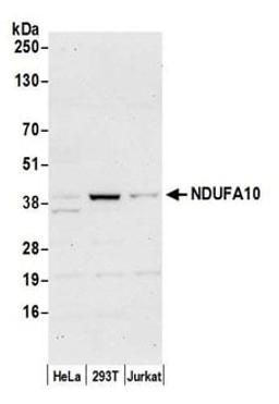 Detection of human NDUFA10 by western blot.