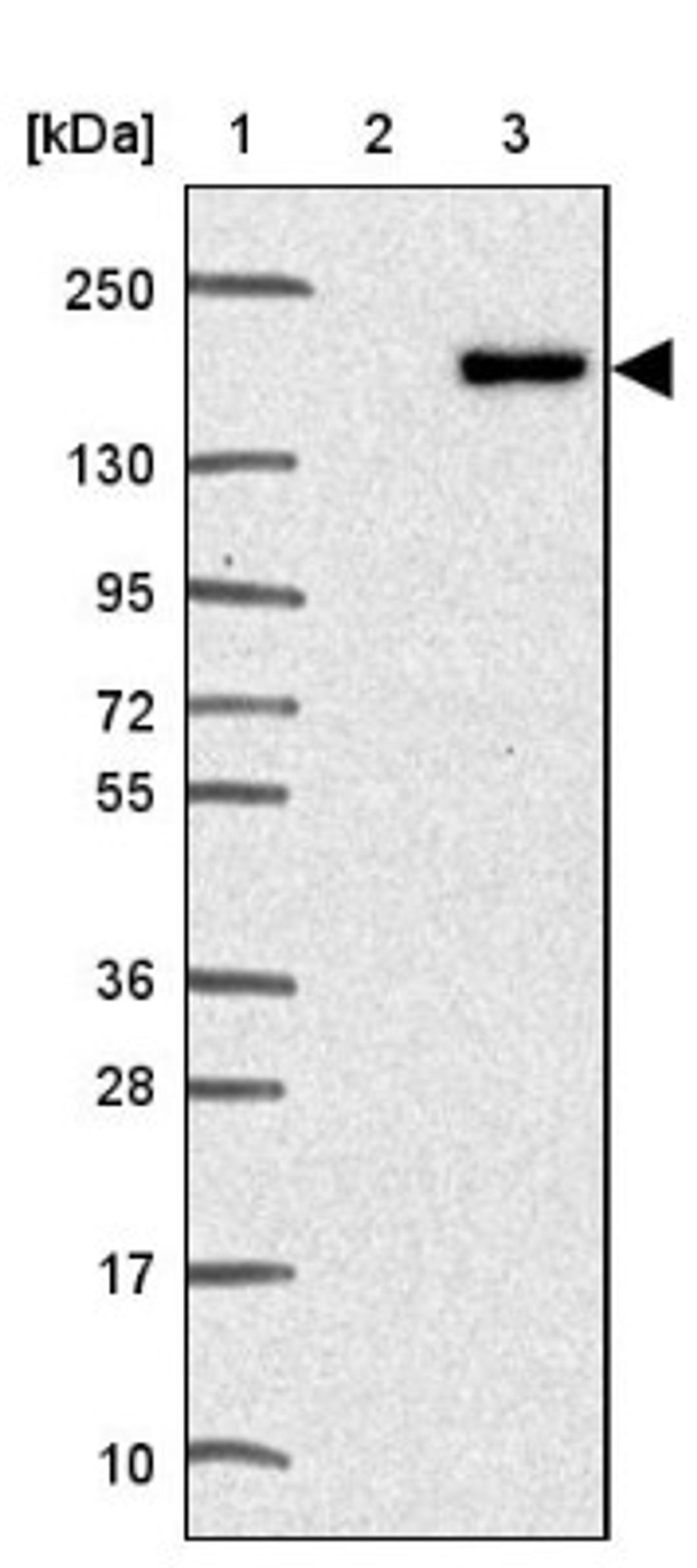 Western Blot: TNS3 Antibody [NBP2-37948] - Lane 1: Marker [kDa] 250, 130, 95, 72, 55, 36, 28, 17, 10<br/>Lane 2: RT-4<br/>Lane 3: U-251 MG