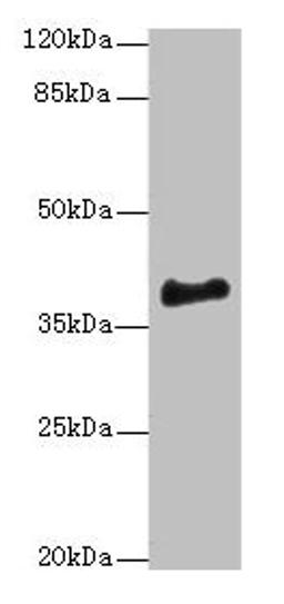 Western blot. All lanes: ERLIN1 antibody at 4µg/ml + Mouse brain tissue. Secondary. Goat polyclonal to rabbit IgG at 1/10000 dilution. Predicted band size: 39 kDa. Observed band size: 39 kDa