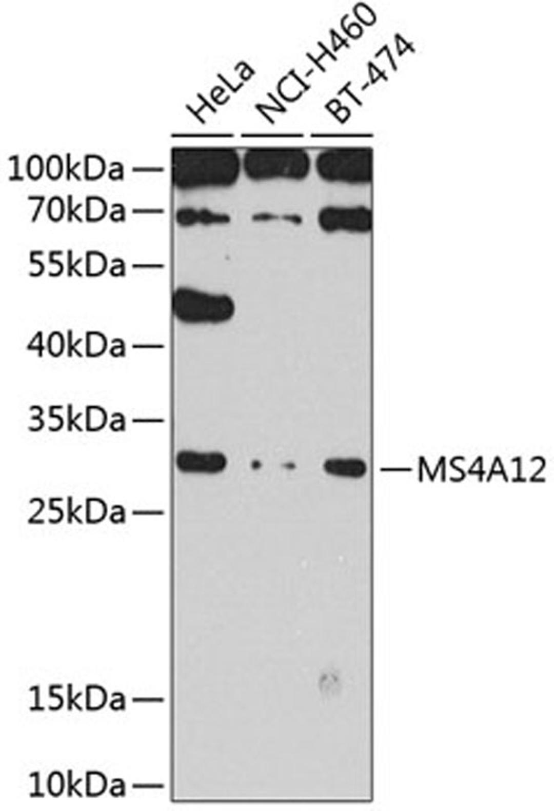 Western blot - MS4A12 antibody (A8223)