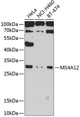 Western blot - MS4A12 antibody (A8223)