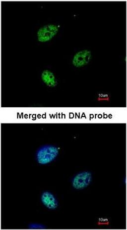 Immunocytochemistry/Immunofluorescence: Importin alpha 3/KPNA4 Antibody [NBP1-31260] - Analysis of HeLa, using KPNA4 antibody at 1:200 dilution.