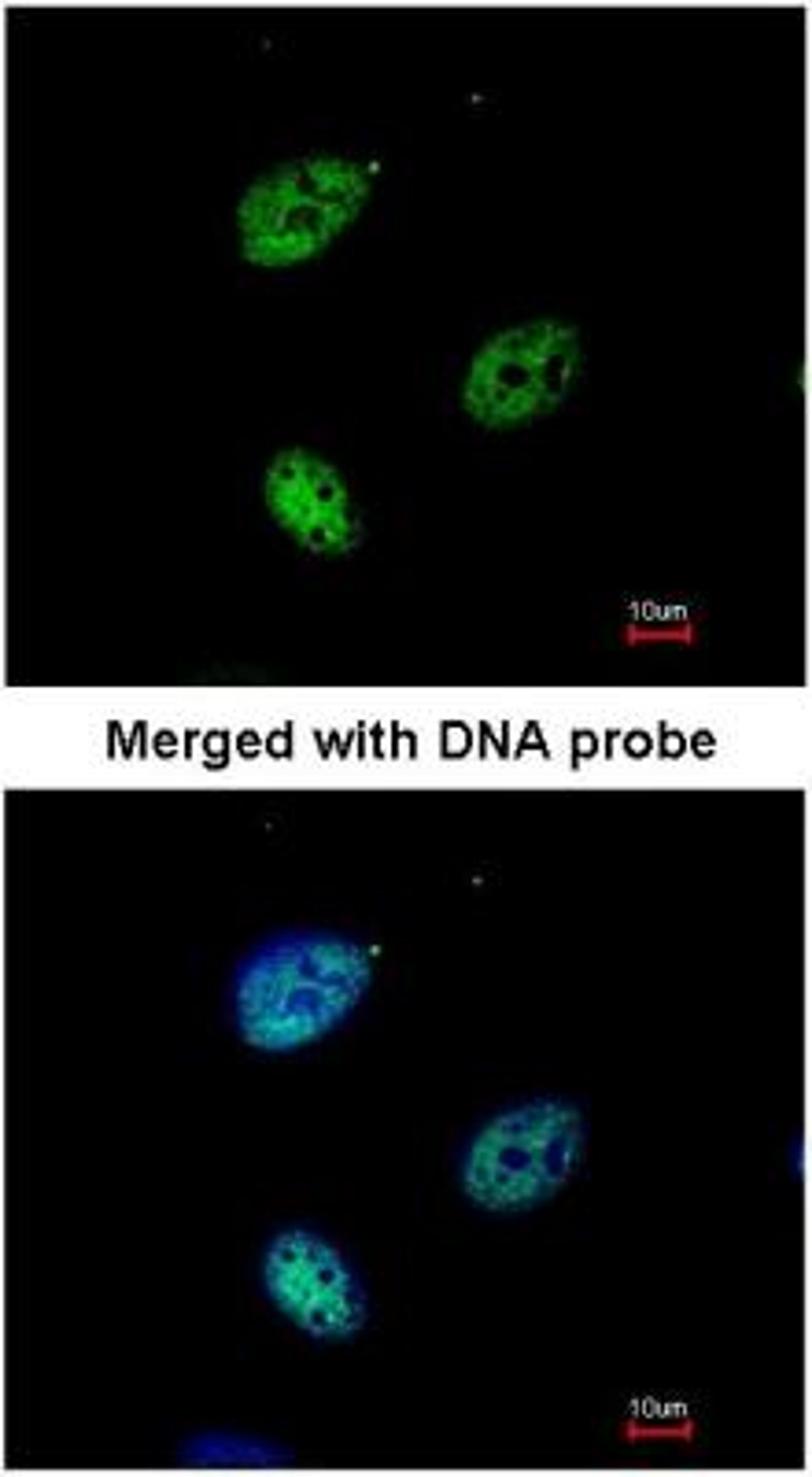 Immunocytochemistry/Immunofluorescence: Importin alpha 3/KPNA4 Antibody [NBP1-31260] - Analysis of HeLa, using KPNA4 antibody at 1:200 dilution.