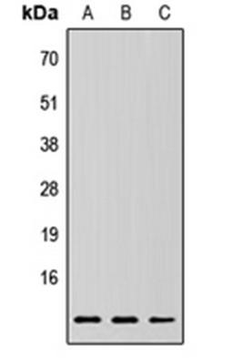 Western blot analysis of HEK293T (Lane 1), Raw264.7 (Lane 2), H9C2 (Lane 3) whole cell lysates using RPLP2 antibody