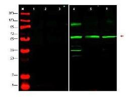 Western blot analysis of whole cell lysates from human derived cell lines HeLa using PTEN-P1 antibody