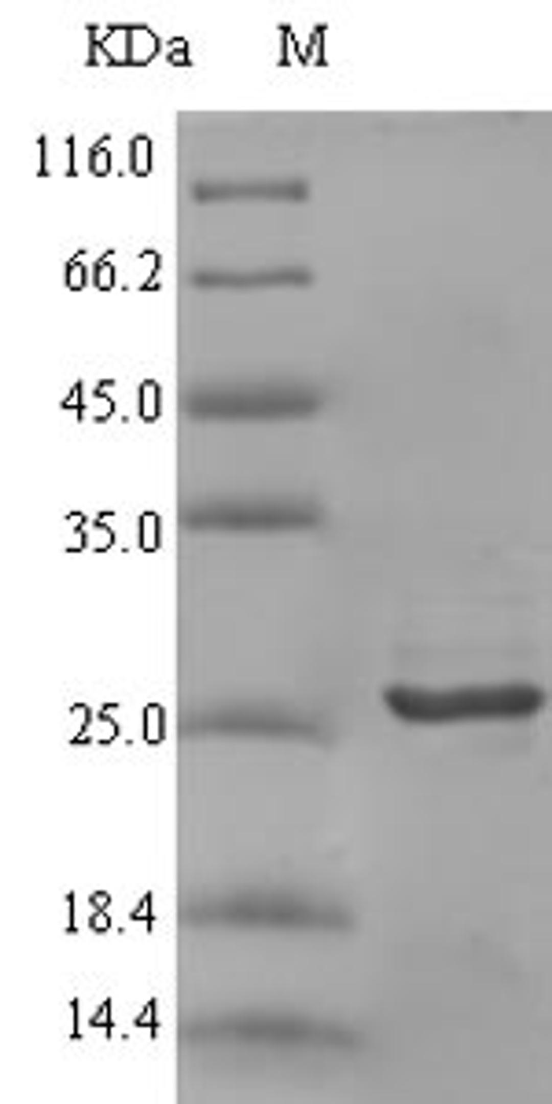 (Tris-Glycine gel) Discontinuous SDS-PAGE (reduced) with 5% enrichment gel and 15% separation gel.