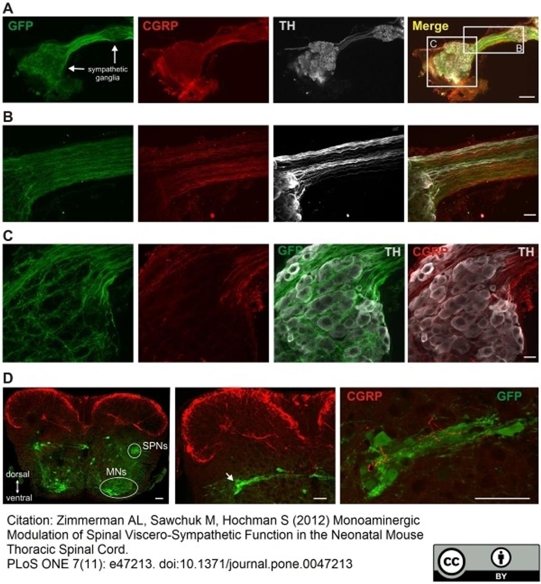 Goat anti Rat calcitonin gene related peptide used for the detection of CRGP expressing axons