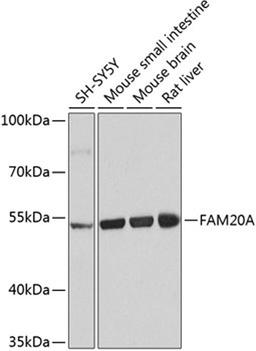 Western blot - FAM20A antibody (A8496)