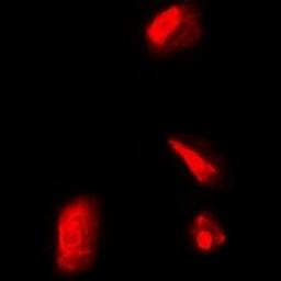 Immunofluorescense analysis of Hela cells using RPS5 antibody