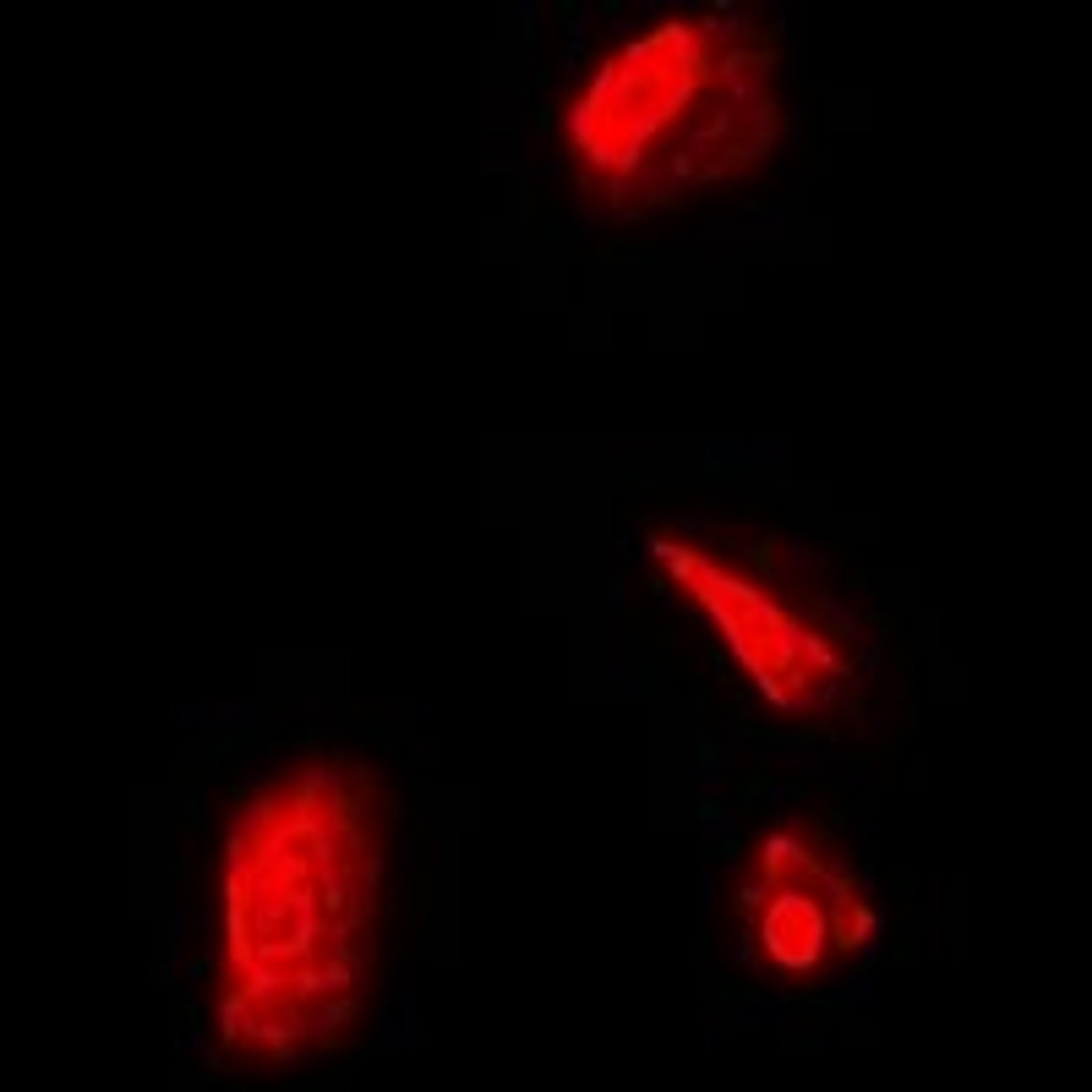 Immunofluorescense analysis of Hela cells using RPS5 antibody