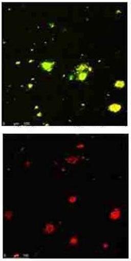 Immunofluorescence analysis of human brain section tissue using Beta Amyloid pyro E3 antibody