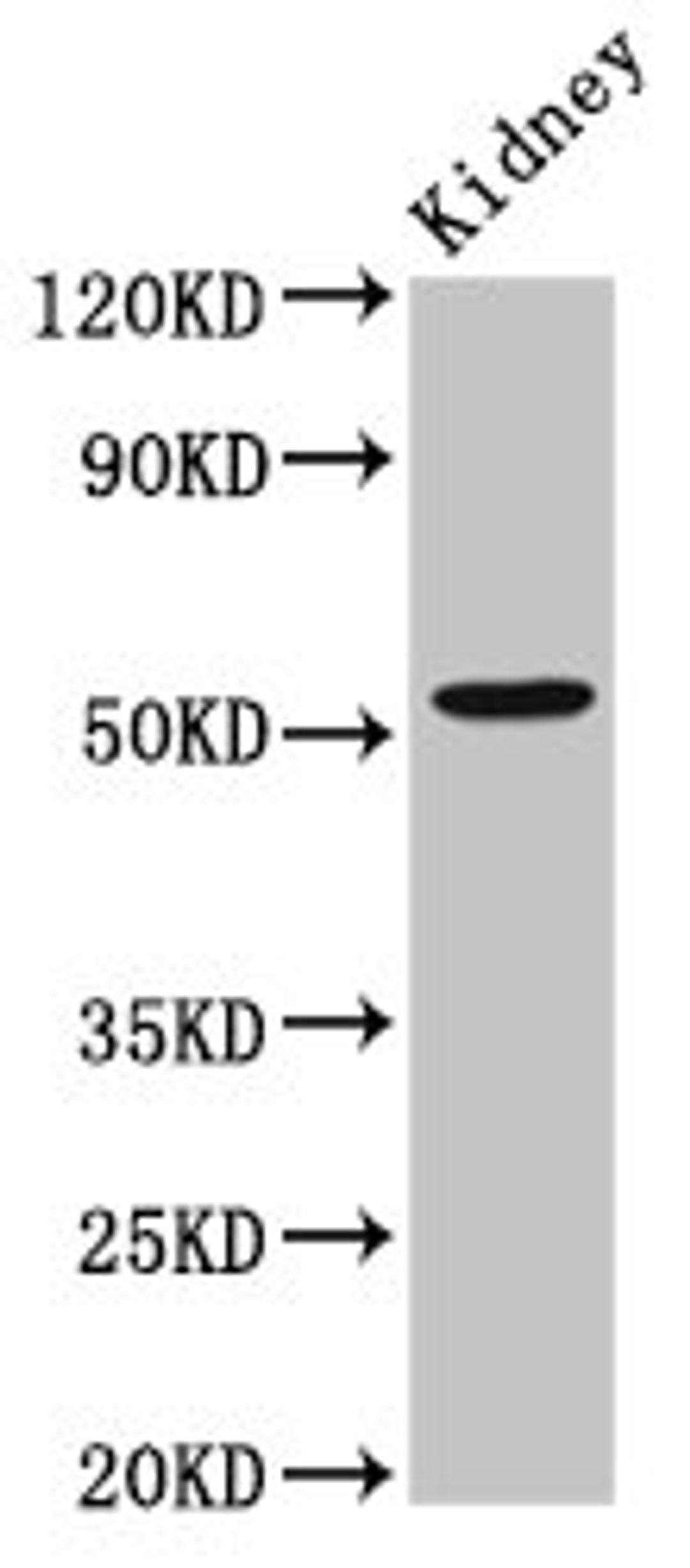 Western Blot. Positive WB detected in: Rat kidney tissue. All lanes: ZFP36L2 antibody at 2.6ug/ml. Secondary. Goat polyclonal to rabbit IgG at 1/50000 dilution. Predicted band size: 52 kDa. Observed band size: 52 kDa.