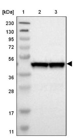 Western Blot: SNF5 Antibody [NBP1-90013] - Lane 1: Marker [kDa] 230, 130, 95, 72, 56, 36, 28, 17, 11<br/>Lane 2: Human cell line RT-4<br/>Lane 3: Human cell line U-251MG sp