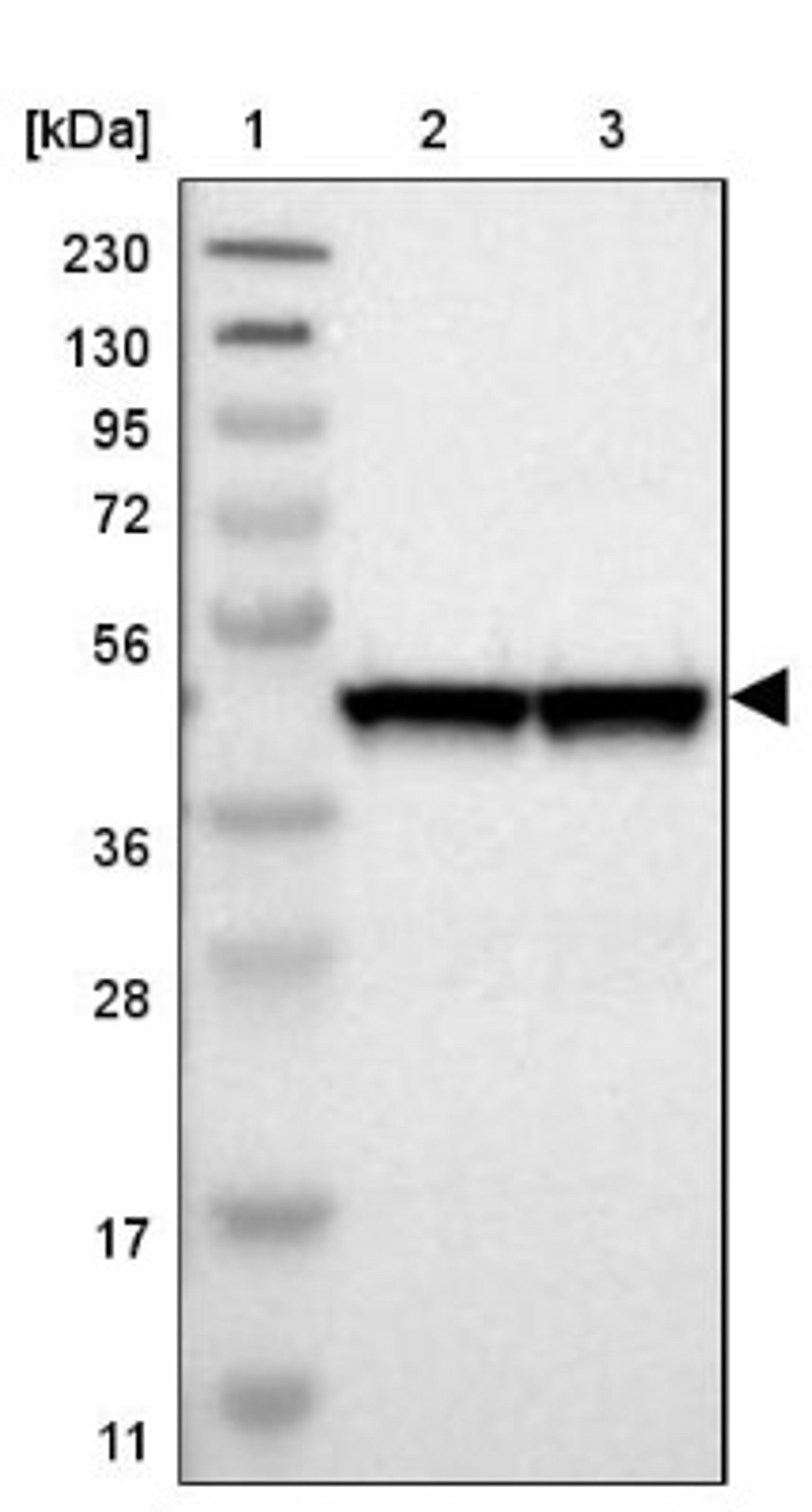 Western Blot: SNF5 Antibody [NBP1-90013] - Lane 1: Marker [kDa] 230, 130, 95, 72, 56, 36, 28, 17, 11<br/>Lane 2: Human cell line RT-4<br/>Lane 3: Human cell line U-251MG sp