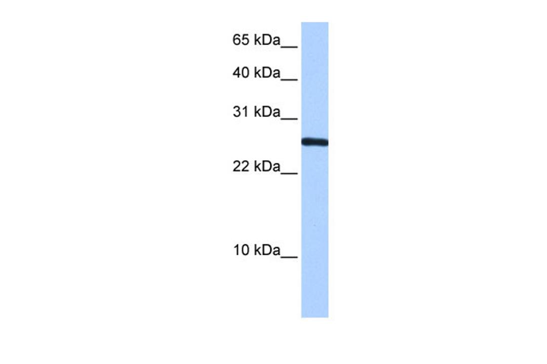 Antibody used in WB on Human HepG2 at 0.2-1 ug/ml.