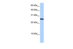 Antibody used in WB on Human HepG2 at 0.2-1 ug/ml.