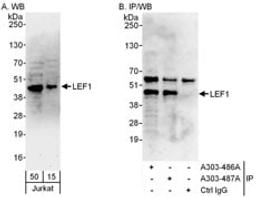 Detection of human LEF1 by western blot and immunoprecipitation.