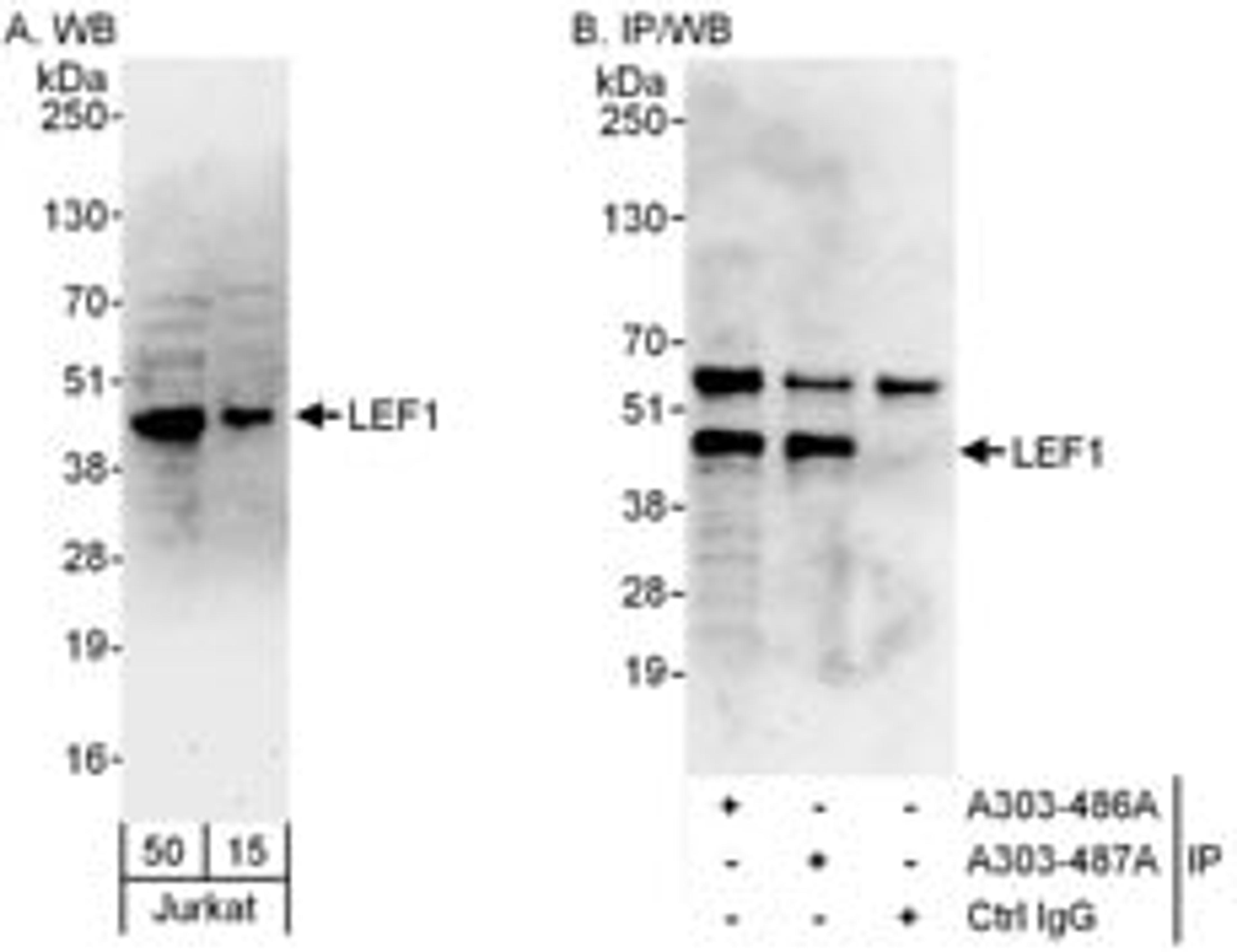 Detection of human LEF1 by western blot and immunoprecipitation.