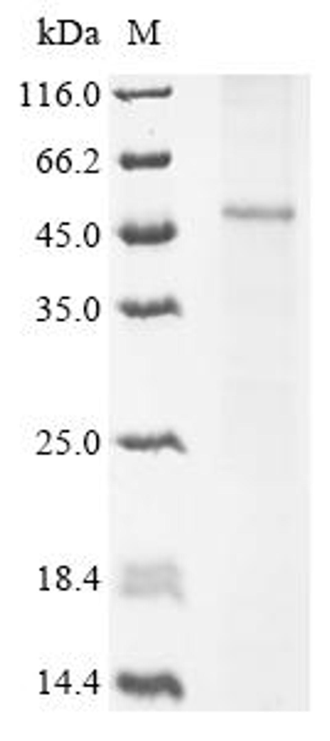 (Tris-Glycine gel) Discontinuous SDS-PAGE (reduced) with 5% enrichment gel and 15% separation gel.