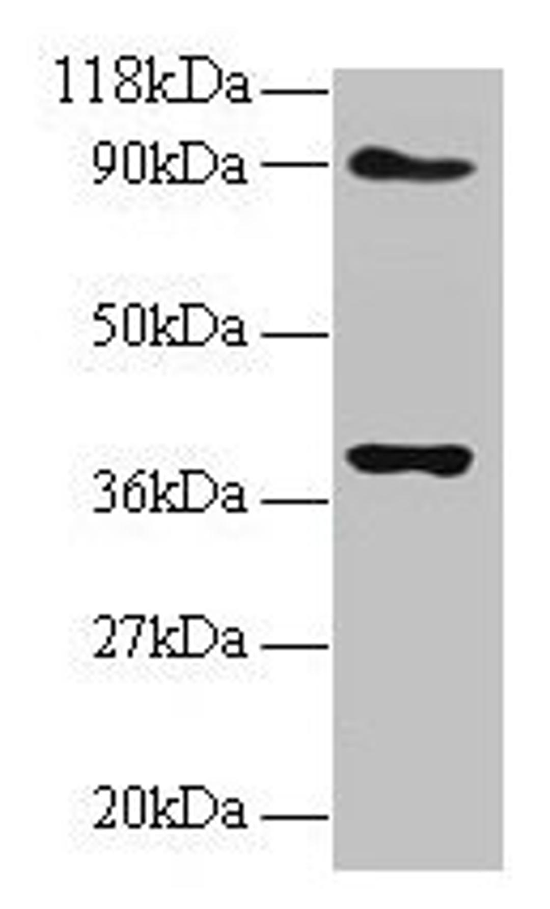 Western blot. All lanes: NDUFS5 antibody at 2µg/ml. Lane 1: EC109 whole cell lysate. Lane 2: 293T whole cell lysate. Secondary. Goat polyclonal to rabbit IgG at 1/15000 dilution. Predicted band size: 13 kDa. Observed band size: 40 kDa
