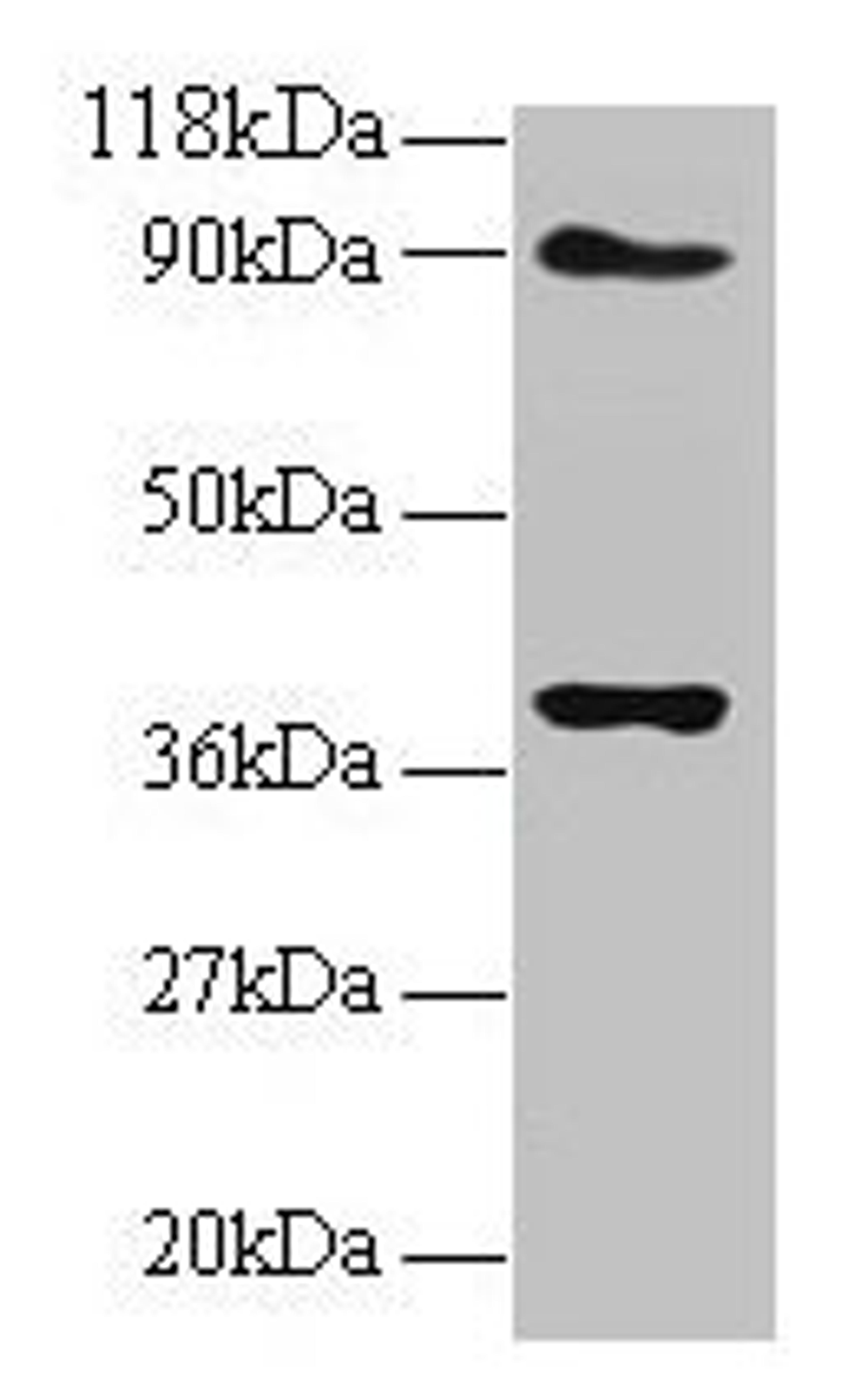 Western blot. All lanes: NDUFS5 antibody at 2µg/ml. Lane 1: EC109 whole cell lysate. Lane 2: 293T whole cell lysate. Secondary. Goat polyclonal to rabbit IgG at 1/15000 dilution. Predicted band size: 13 kDa. Observed band size: 40 kDa