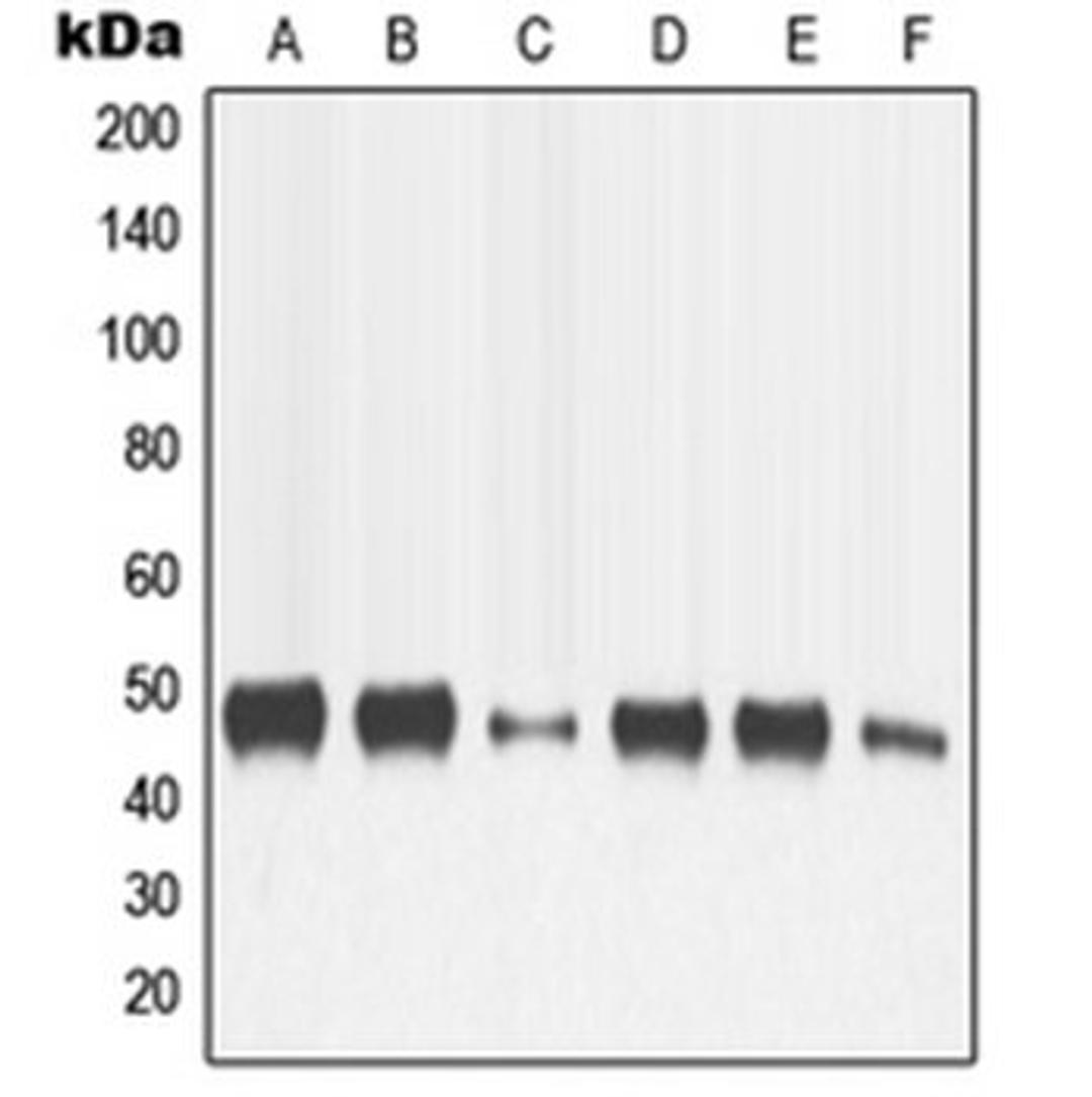 Western blot analysis of HeLa (Lane 1), SP2/0 (Lane 2), H9C2 (Lane 3), MCF7 (Lane 4), HT1080 (Lane 5), SCC4 (Lane 6) whole cell lysates using MMP13 antibody